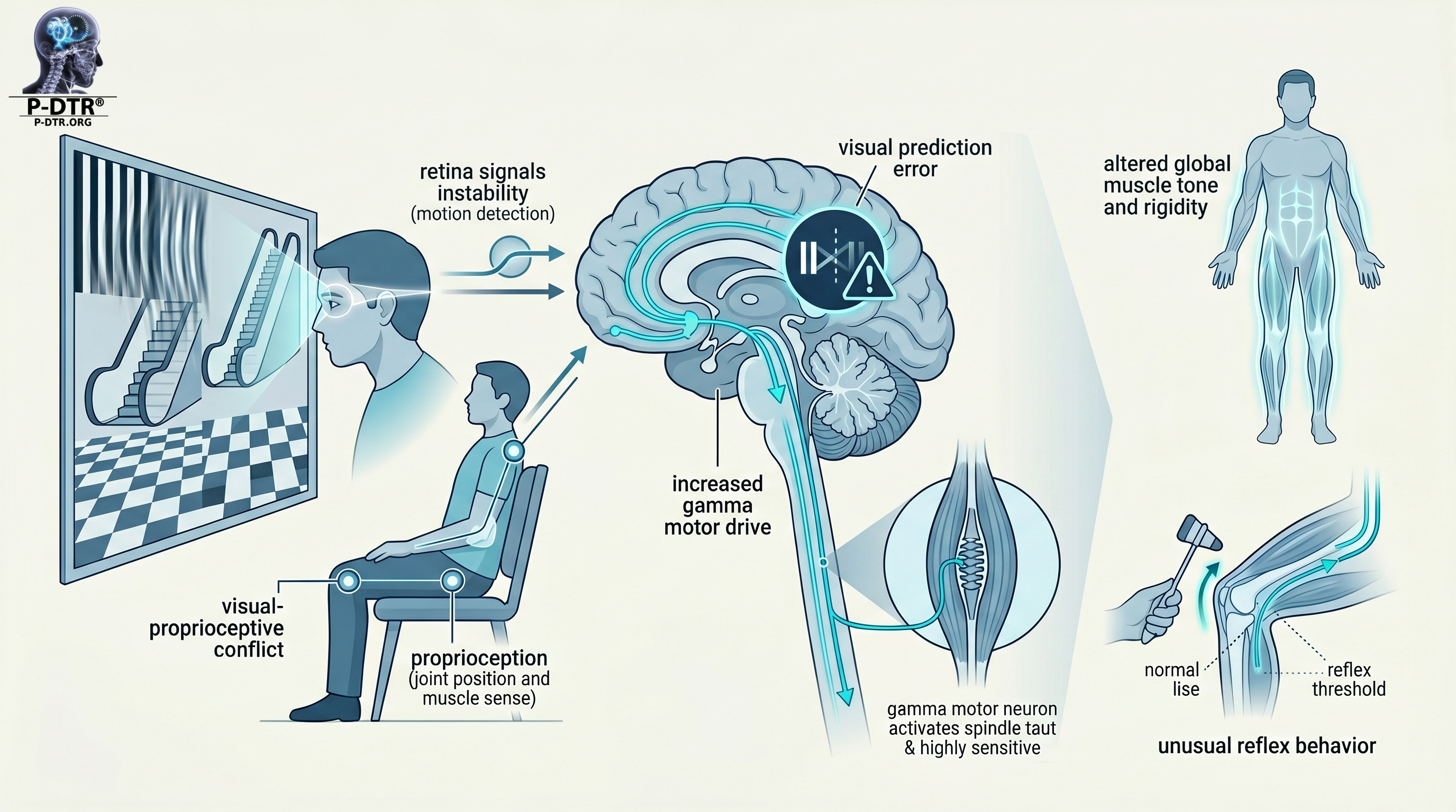 Desajuste sensorial visual y errores de expectativa, ilustración 3